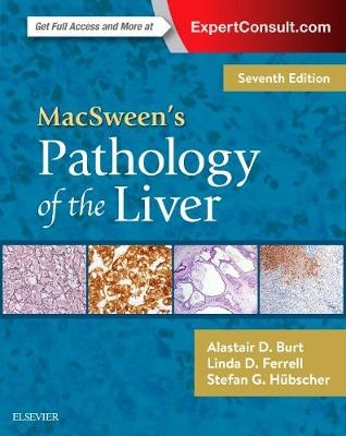 MacSween's Pathology of the Liver - Alastair D. Burt, Linda D. Ferrell, Stefan G. H&uuml;bscher