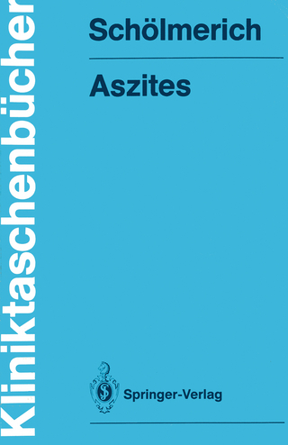 Aszites