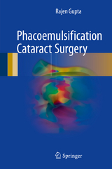 Phacoemulsification Cataract Surgery - Rajen Gupta