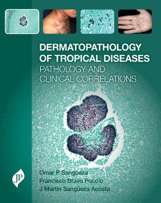 Dermatopathology of Tropical Diseases - Omar P Sang&uuml;eza, Martin Sang&uuml;eza, Francisco Bravo
