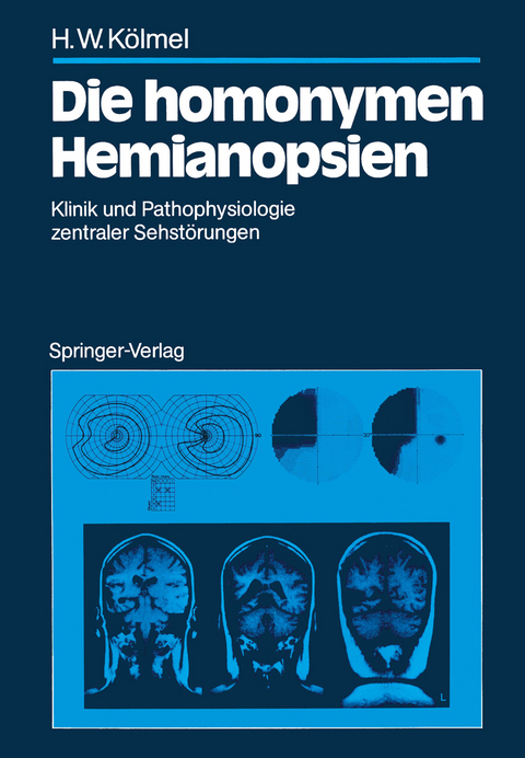 Die homonymen Hemianopsien - Hans W. K&ouml;lmel