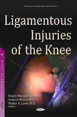 Ligamentous Injuries of the Knee - 