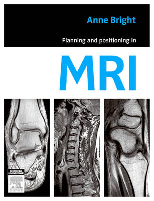 Planning and Positioning in Mri - E-Book