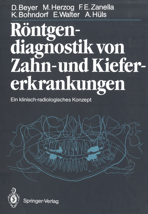 R&ouml;ntgendiagnostik von Zahn- und Kiefererkrankungen - Dieter Beyer, Michael Herzog, Friedhelm Zanella, Klaus Bohndorf, Eberhard Walter, Alfons H&uuml;ls