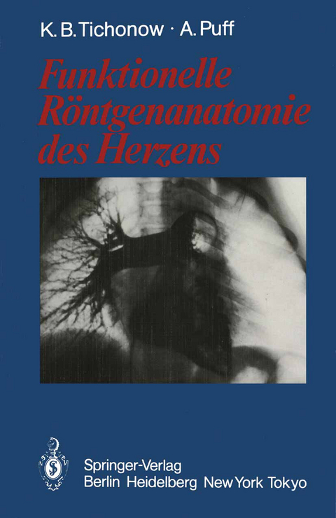 Funktionelle R&ouml;ntgenanatomie des Herzens - Konstantin B. Tichonow, Alexander Puff