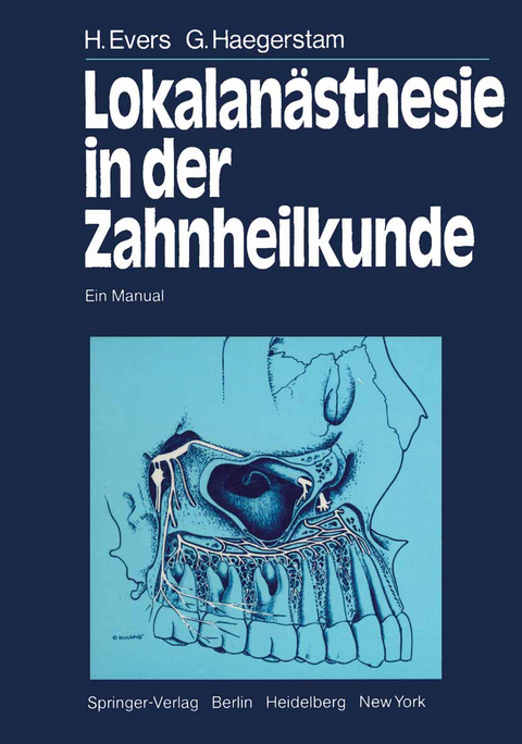 Lokalan&auml;sthesie in der Zahnheilkunde - H. Evers, G. Haegerstam