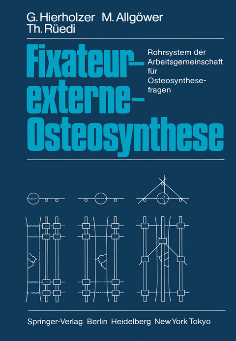 Fixateur-externe-Osteosynthese - G. Hierholzer, M. Allg&ouml;wer, Thomas R&uuml;edi