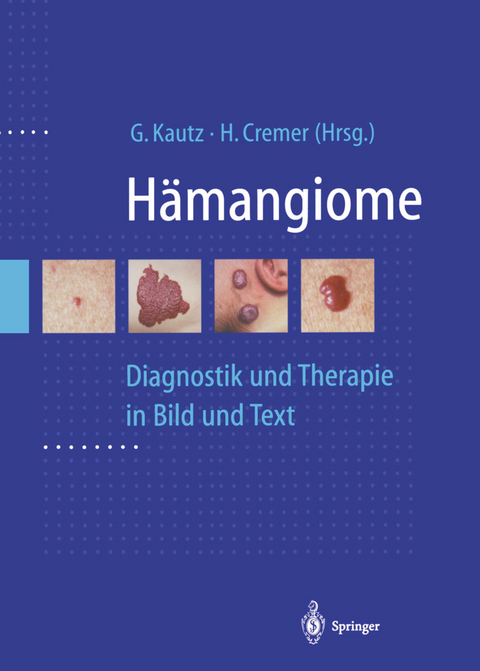H&auml;mangiome - 