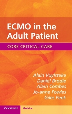 ECMO in the Adult Patient