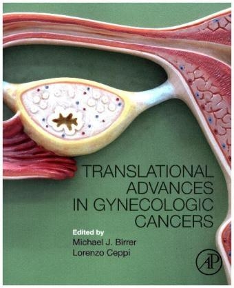 Translational Advances in Gynecologic Cancers - 