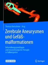 Zerebrale Aneurysmen und Gef&auml;&szlig;malformationen - 