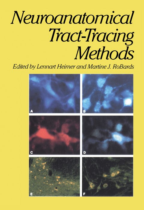 Neuroanatomical Tract-Tracing Methods - Lennart Heimer, Martine J. Robards