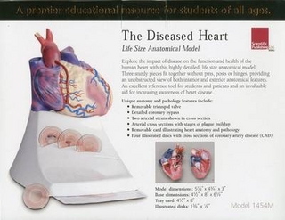 Life Size Diseased Heart Model