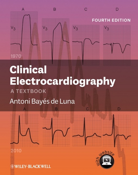 Clinical Electrocardiography - Antoni Bayes de Luna
