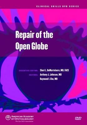 Repair of the Open Globe