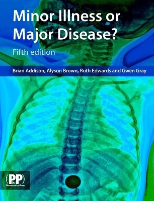 Minor Illness or Major Disease? -  Pharmaceutical Press, Alyson Brown, Ruth Edwards