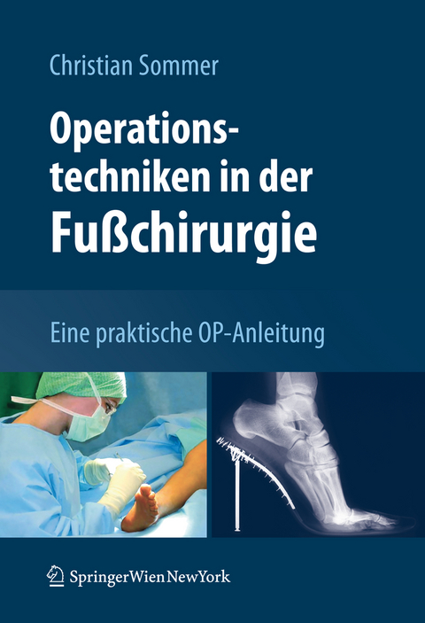 Operationstechniken in der Fu&szlig;chirurgie - Christian Sommer
