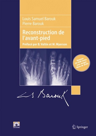 Reconstruction De L'Avant-Pied