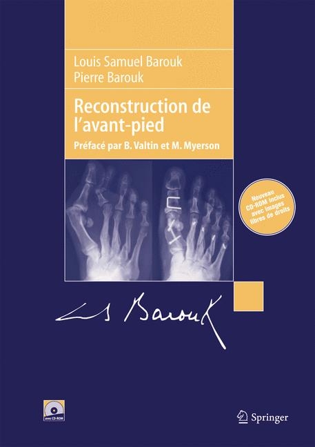 Reconstruction De L'Avant-Pied - L. S Barouk