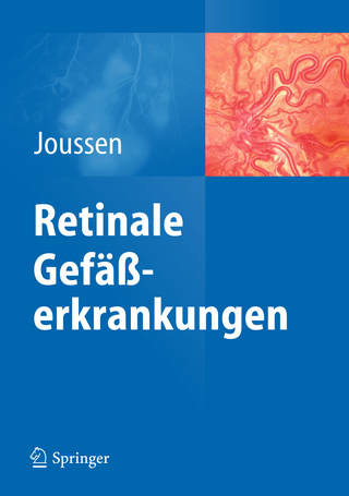 Retinale Gefäßerkrankungen
