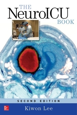 The NeuroICU Book, Second Edition