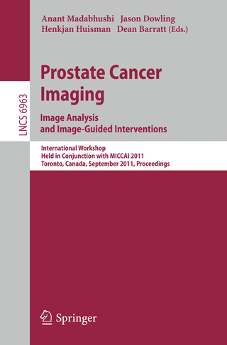Prostate Cancer Imaging. Image Analysis and Image-Guided Interventions
