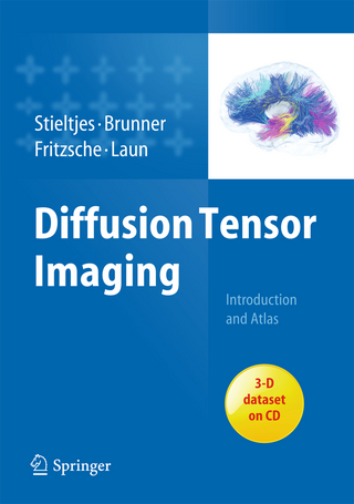 Diffusion Tensor Imaging