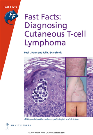Fast Facts: Diagnosing Cutaneous T-cell Lymphoma