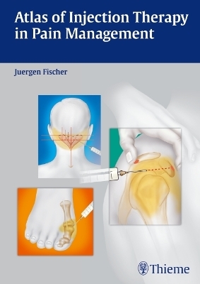 Atlas of Injection Therapy in Pain Management - J&uuml;rgen Fischer