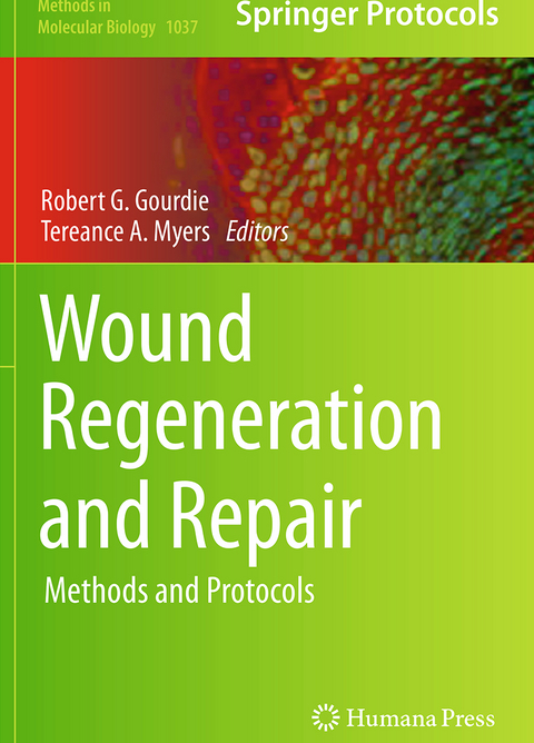 Wound Regeneration and Repair - 