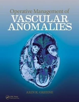 Operative Management of Vascular Anomalies