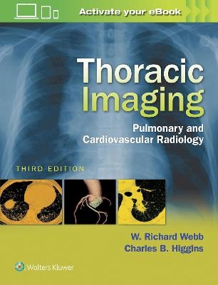 Thoracic Imaging - W. Richard Webb, Charles B. Higgins