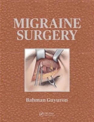Migraine Surgery