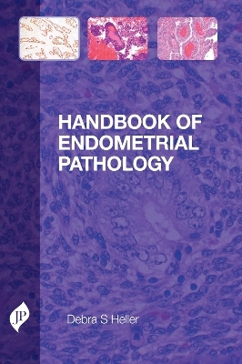 Handbook of Endometrial Pathology - Debra S. Heller