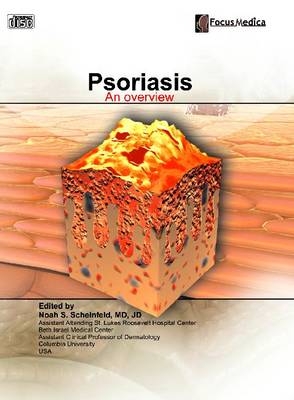 Psoriasis - 