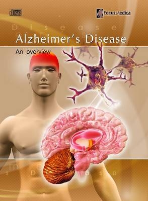 Alzheimer's Disease - 