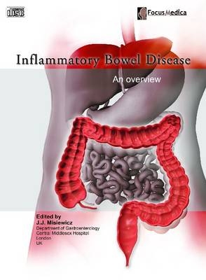 Inflammatory Bowel Disease