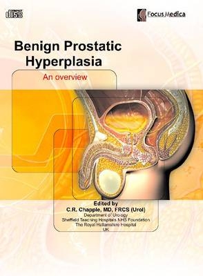 Benign Prostatic Hyperplasia