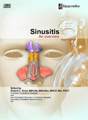 Sinusitis