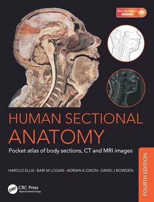 Human Sectional Anatomy - Bari M. Logan, Harold Ellis, Adrian Kendal Dixon, David J. Bowden