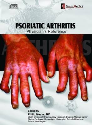 Psoriatic Arthritis - 