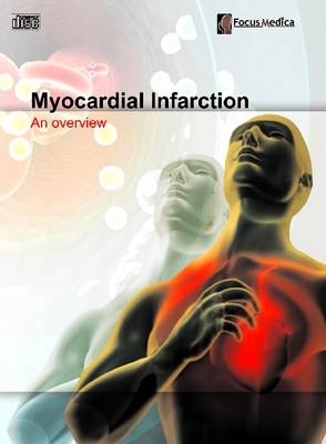 Myocardial Infarction - 