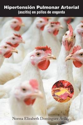 Hipertensi&oacute;n pulmonar arterial - Norma Elizabeth Dom&iacute;nguez Avila