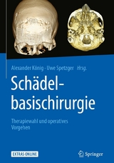 Sch&auml;delbasischirurgie - 