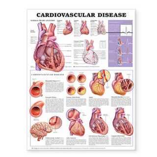 Cardiovascular Disease Anatomical Chart