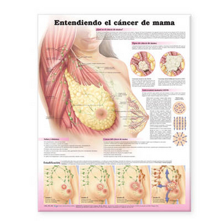Understanding Breast Cancer Spanish