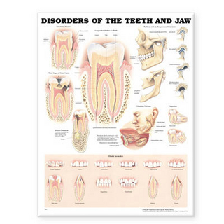 Disorders of the Teeth and Jaw Anatomical Chart