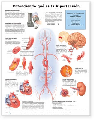 Understanding Hypertension Anatomical Chart in Spanish (Entendiendo Que Es La Hypertension)