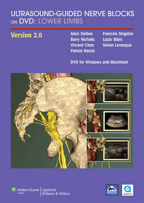 Ultrasound-guided Nerve Blocks on DVD