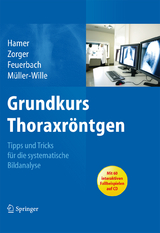 Grundkurs Thoraxr&ouml;ntgen - Okka Hamer, Niels Zorger, Stefan Feuerbach, Ren&eacute; M&uuml;ller-Wille